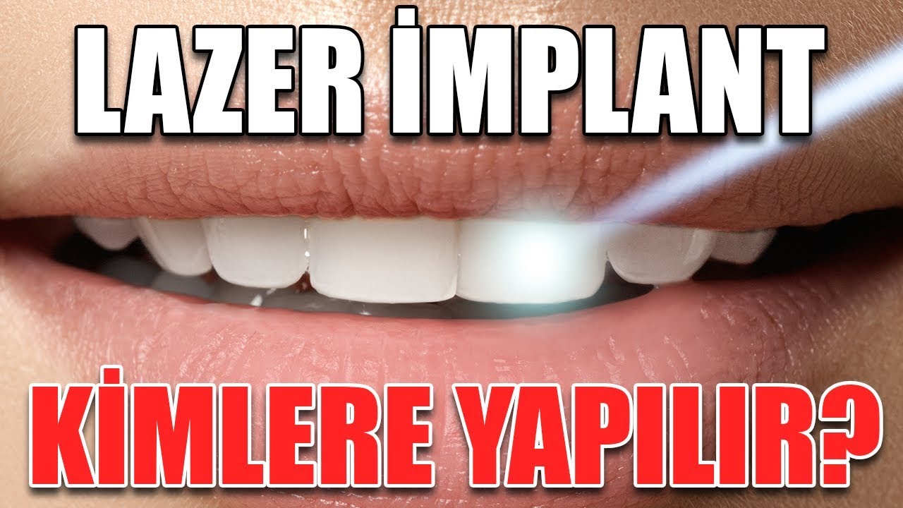 Implant ve Lazer Implant Teknolojisi Nedir? Kimlere Yapılır? | Dr. Turhan Güldaş