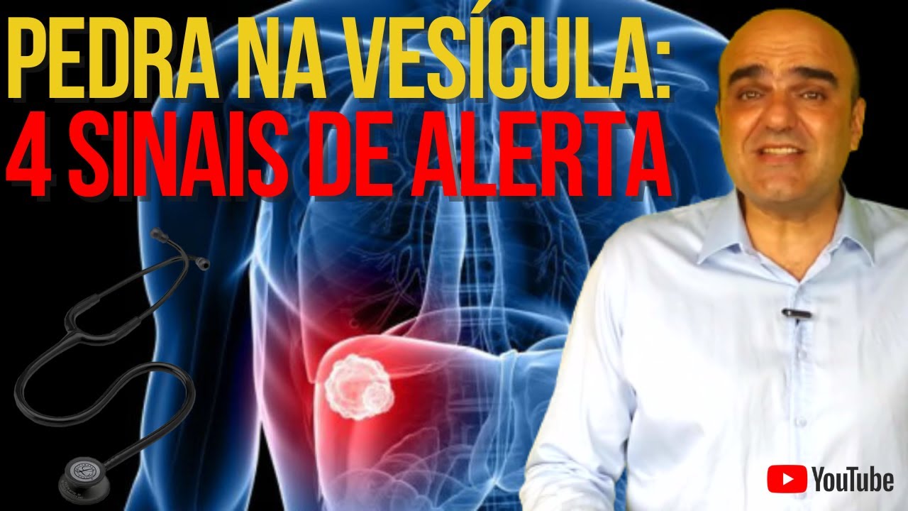 4 sinais e sintomas de alerta para pedra na vesícula
