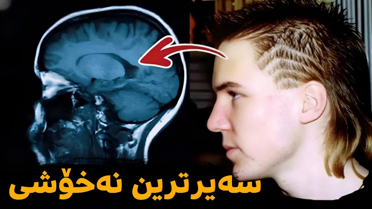 ئەو نەخۆشیەی هەموو کەسێک حەزدەکات توشی بێ ..!! چۆن وای بەسەرهات ..؟