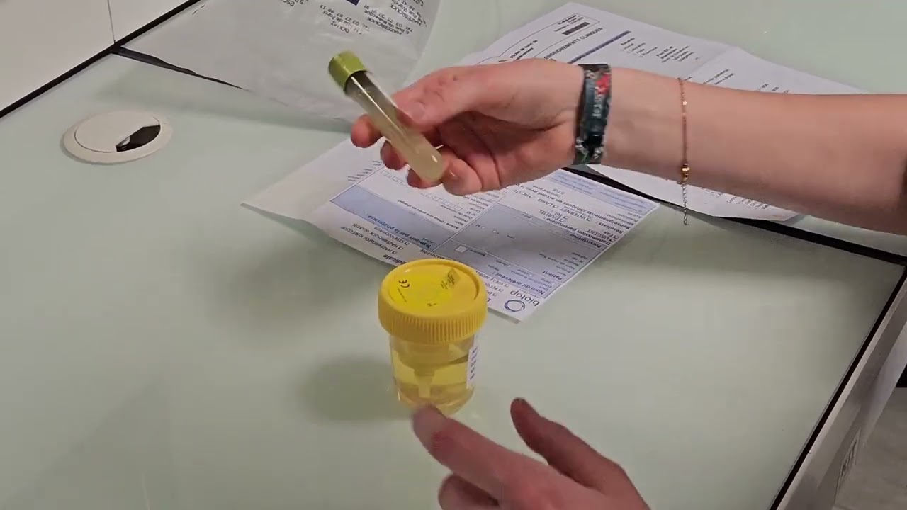ECBU : Comment conserver son urine pour son examen ?