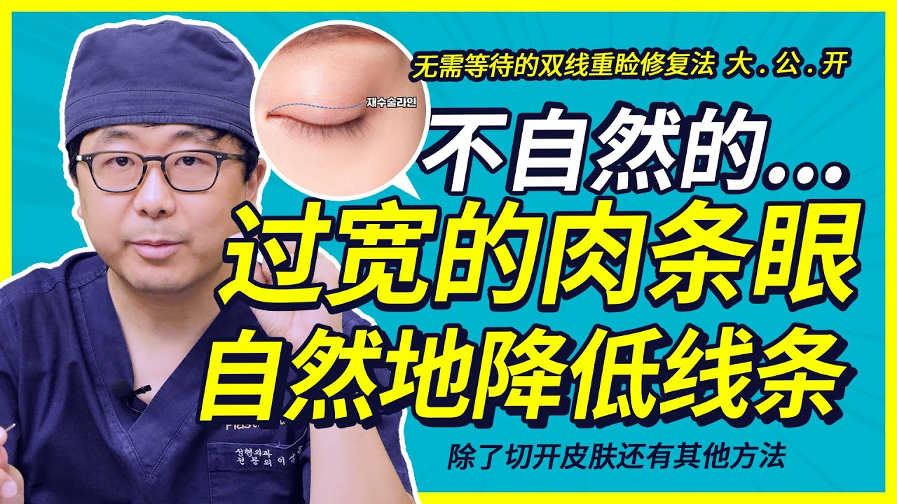 #韩国双眼皮修复#双线重睑是什么？双眼皮做失败了怎么办？请看TS李相均院长详细为您解答！