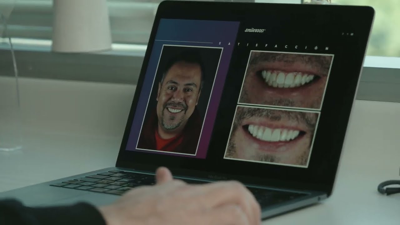 SmileBoost® - Entrevistas