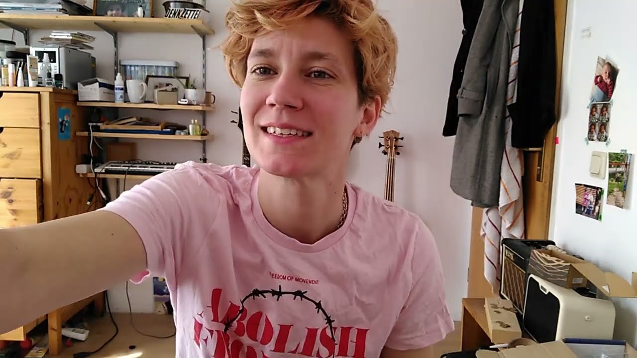 2,5 Monate post op - periareolar Mastektomie - ftm nichtbinär trans topsurgery