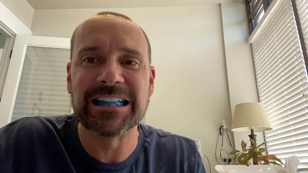 Sleep Apnea dental appliance by Somnomed