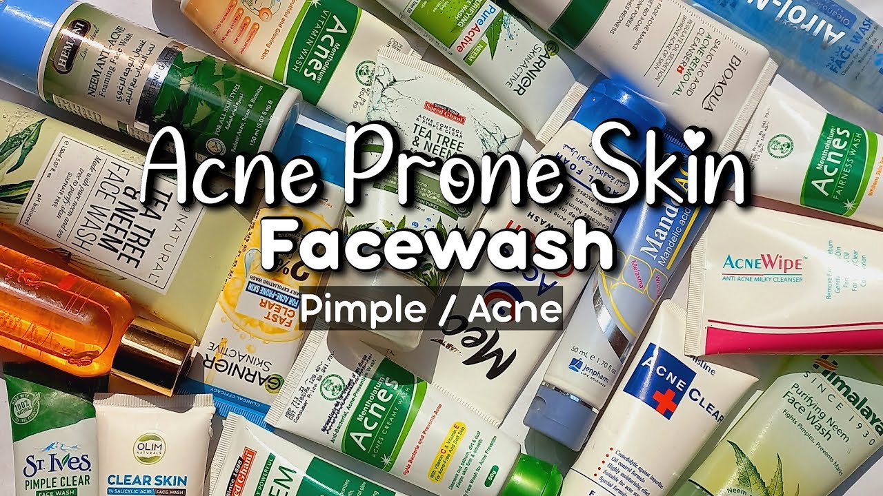 Facewash for Acne and Pimples | best facewash for acne | acne face wash | acne treatment | Acne skin