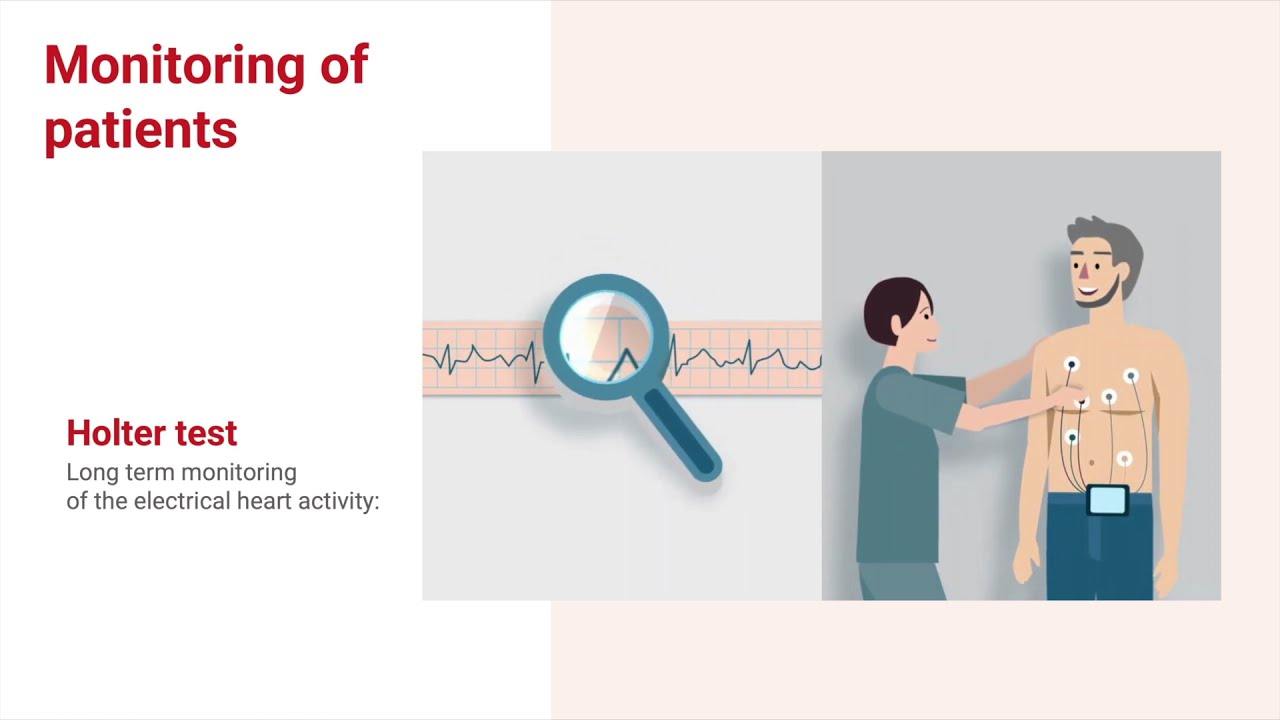 How does the ECG analysis look like with AI?
