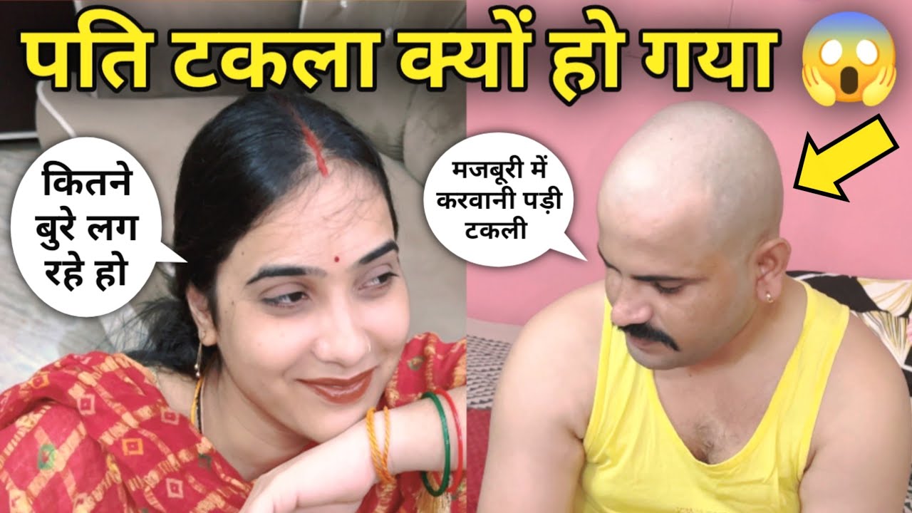 मुझे टकला क्यों होना पड़ा 😔