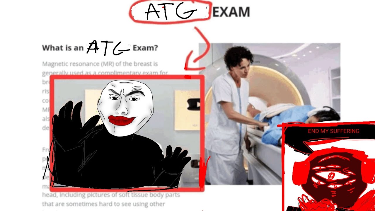 EXPOSED ATG - ATG OWNER IS COOKED !1!!1!1!