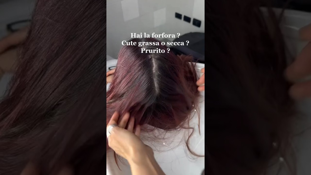 Forfora cute grassa ? Prurito #dermatite  #cute #capelli #storiedalparrucchiere  #consiglicapelli