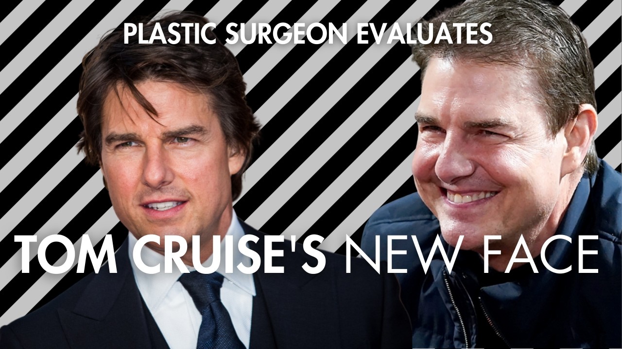 Tom Cruise's New Face: Did Tom Cruise Have Plastic Surgery?