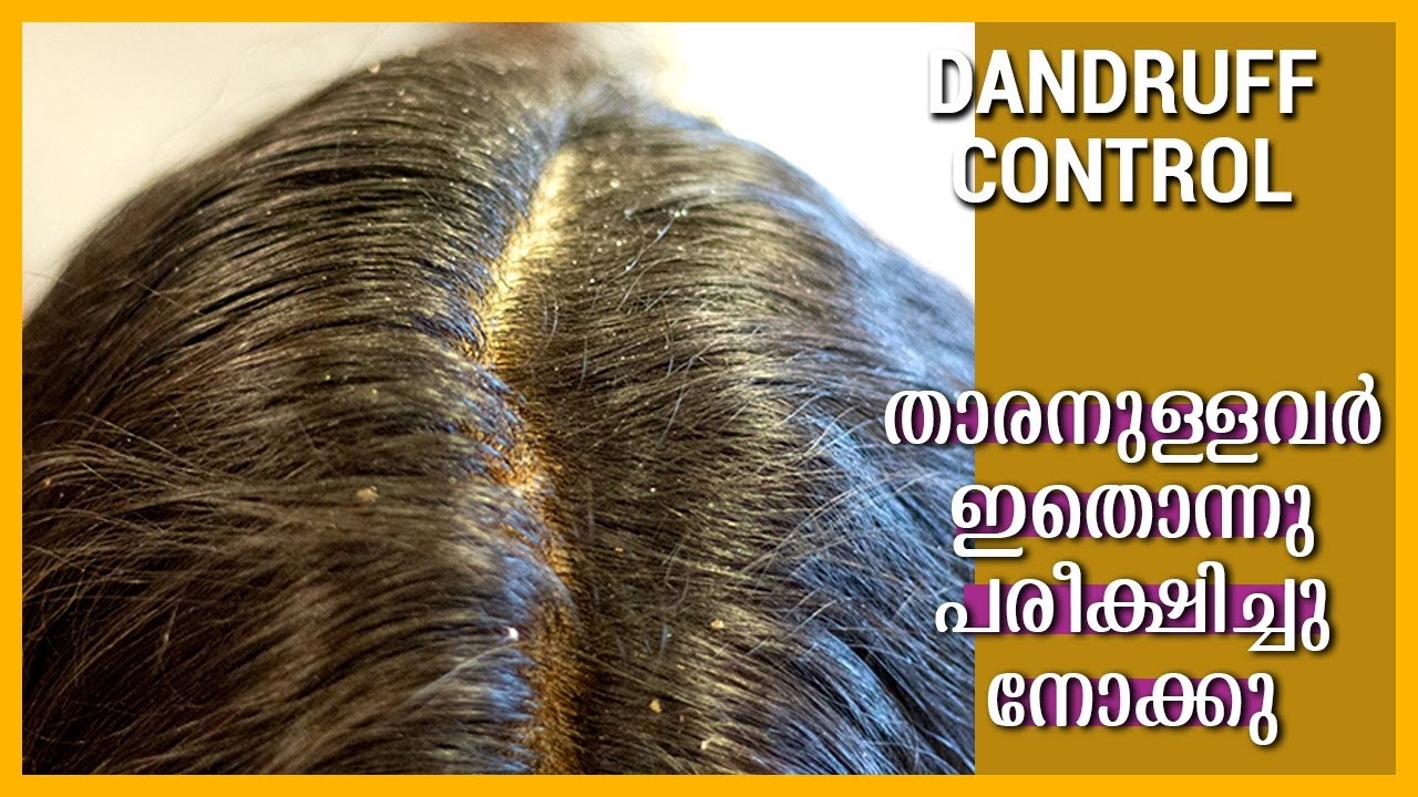 NATURAL HAIR PACK FOR DANDRUFF | താരനും തല ചൊറിച്ചിലിനും നല്ലൊരു ആശ്വസം | Tharan Pokan Malayalam