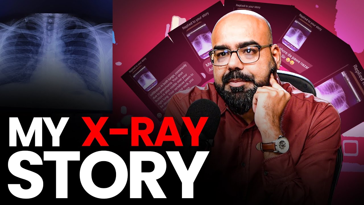 My X-Ray Story | Junaid Akram