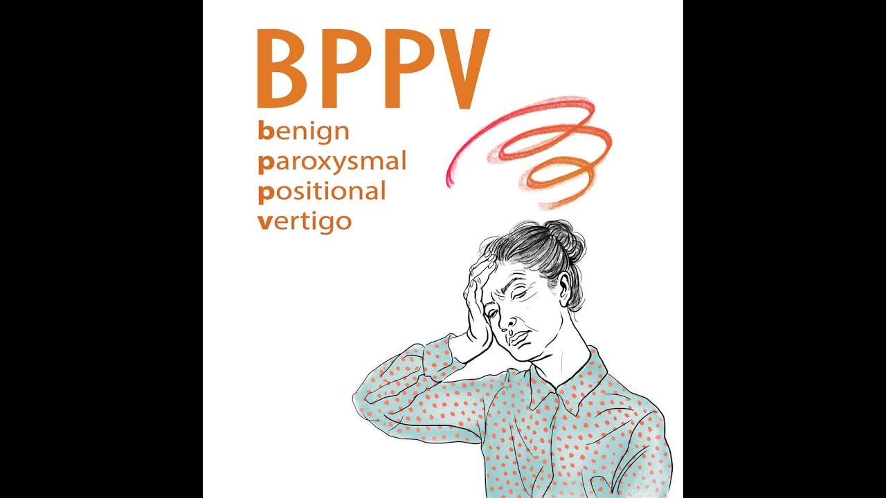 BPPV - Benign Paroxysmal Positional Vertigo-Inner Ear disorders - Vestibular disorder -ENT - Vertigo
