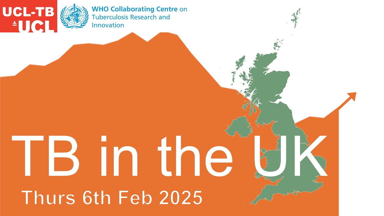 TB in the UK webinar