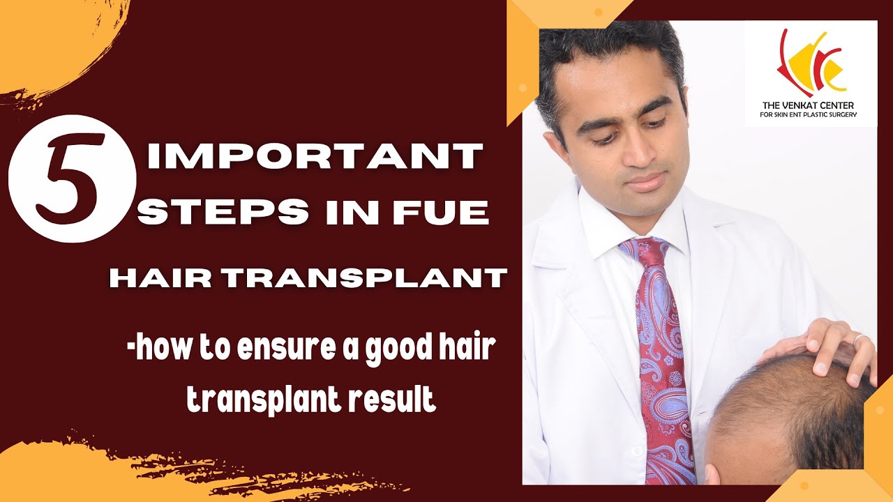 FUE Hair Transplantation (Follicular Unit Extraction) Technique : 5 Important Steps