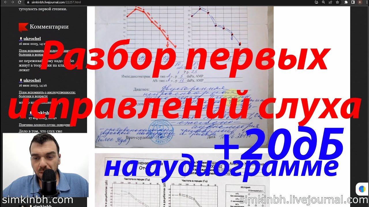 Разбор первых историй исправлений слуха с прогрессом (аудиограмма) 2012-2013