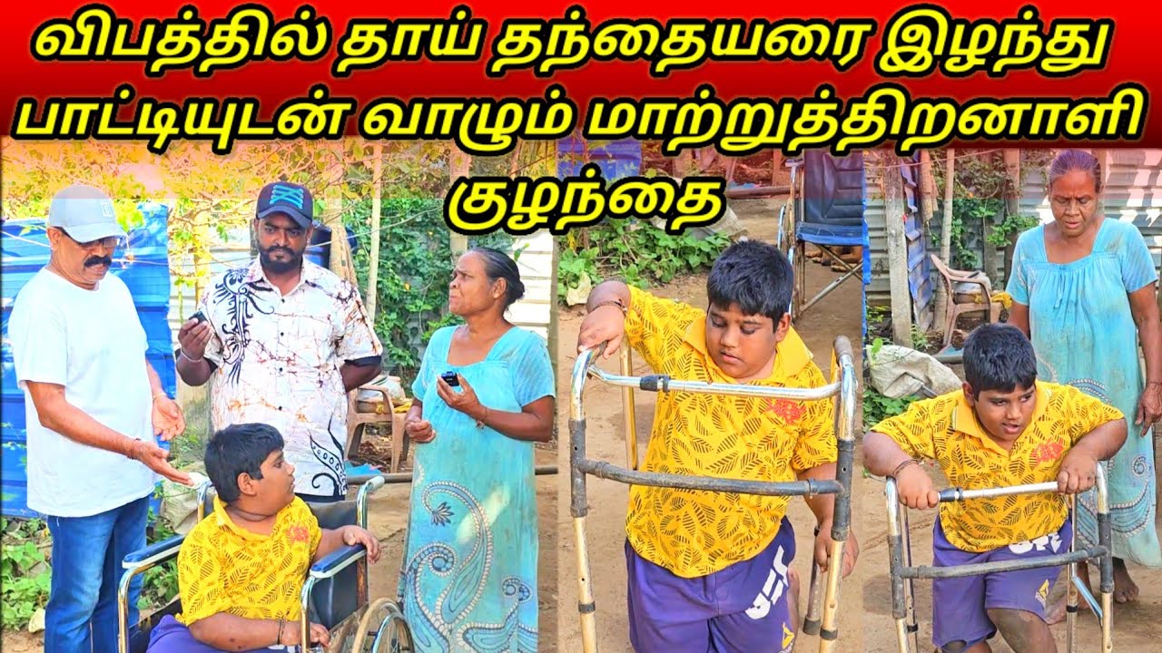 விபத்தில் தாய் தந்தையரை இழந்து  பாட்டியுடன் வாழும் மாற்றுத்திறனாளி குழந்தை./jaffna/SSV VLOG/😥😢😱😱💞💞