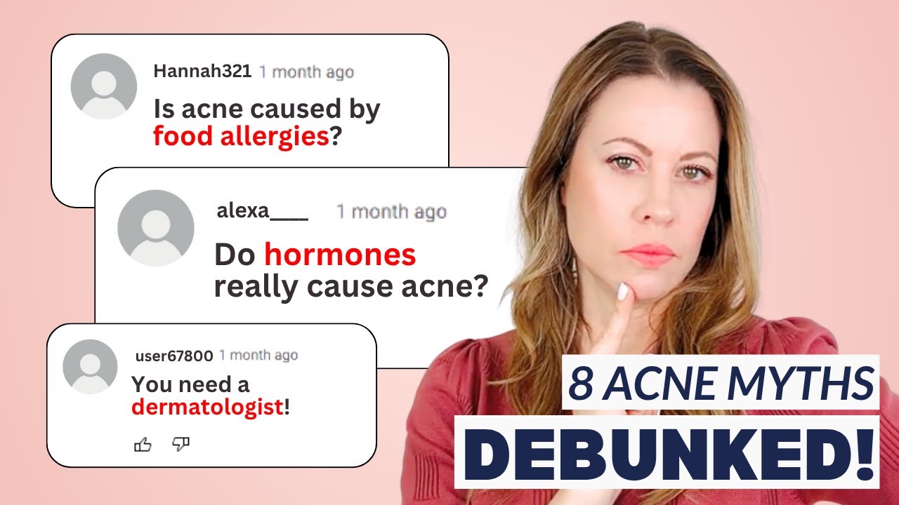 8 Lies About Acne You Probably Still Believe