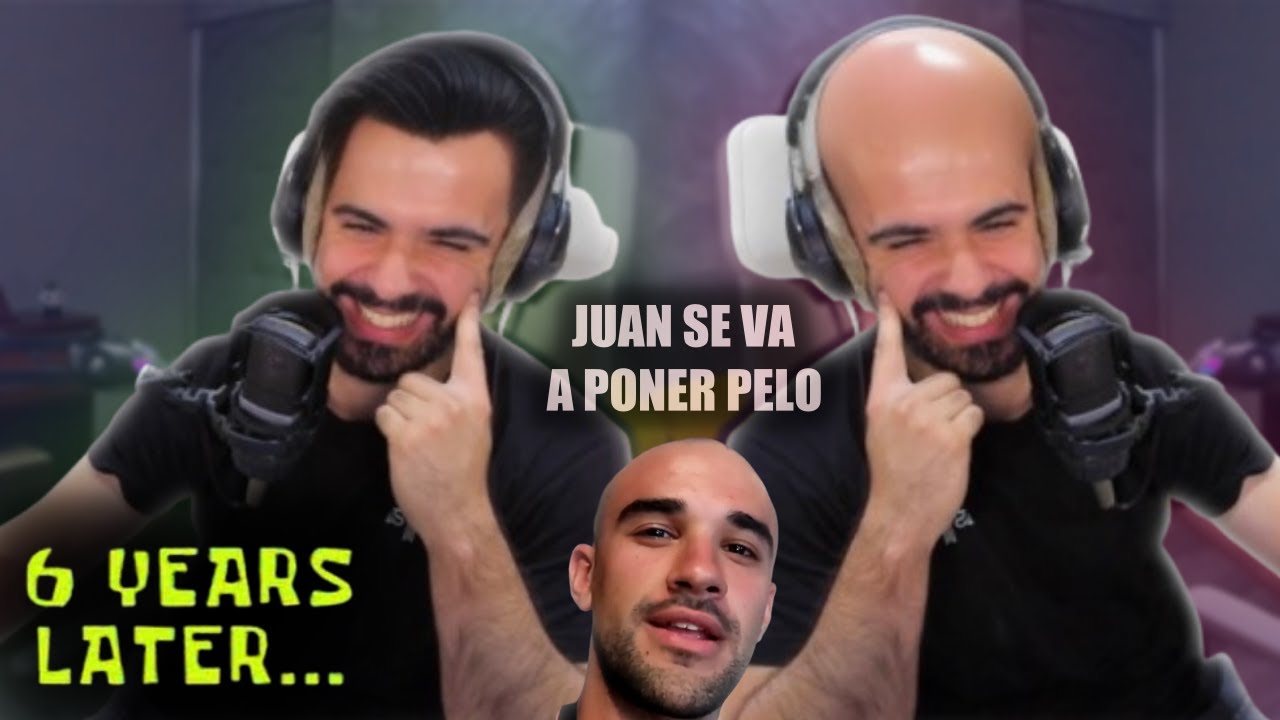ELBOKERON Sobre La CALVICIE y Habla De Que ILLOJUAN Se Quiere Poner Pelo