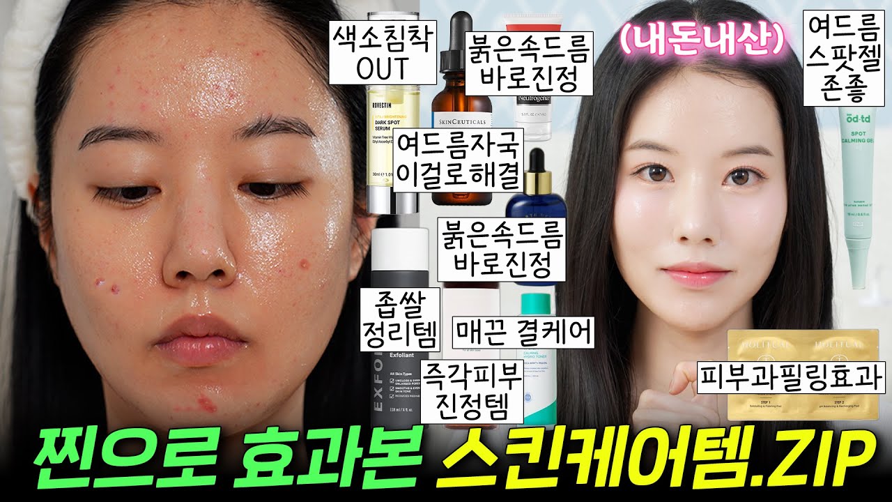 광고❌  과장❌ 찐으로 효과보고 N통째 쓰는 민감/여드름/속건조/홍조 예민피부 스킨케어템.zip🔥