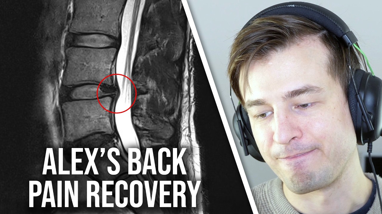 Alex's Back Pain Struggle And The Plan For Recovery