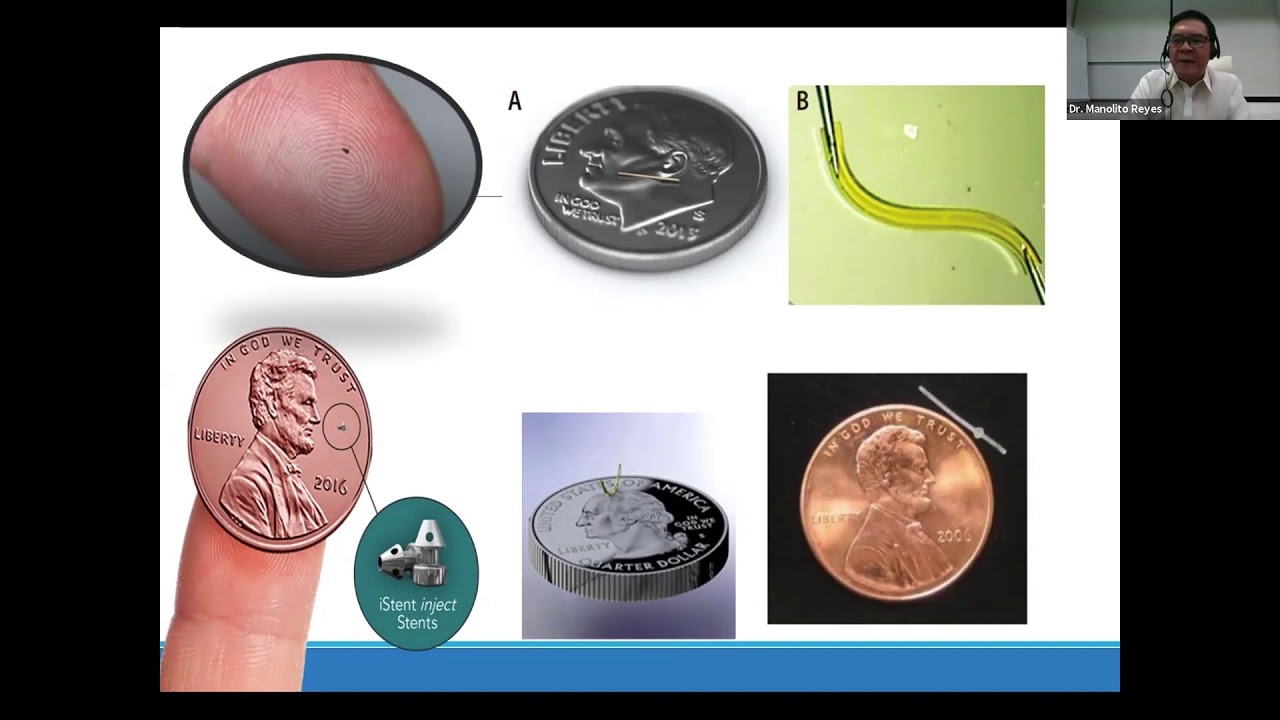 Lecture: Choosing the Right MIGS for your Patient