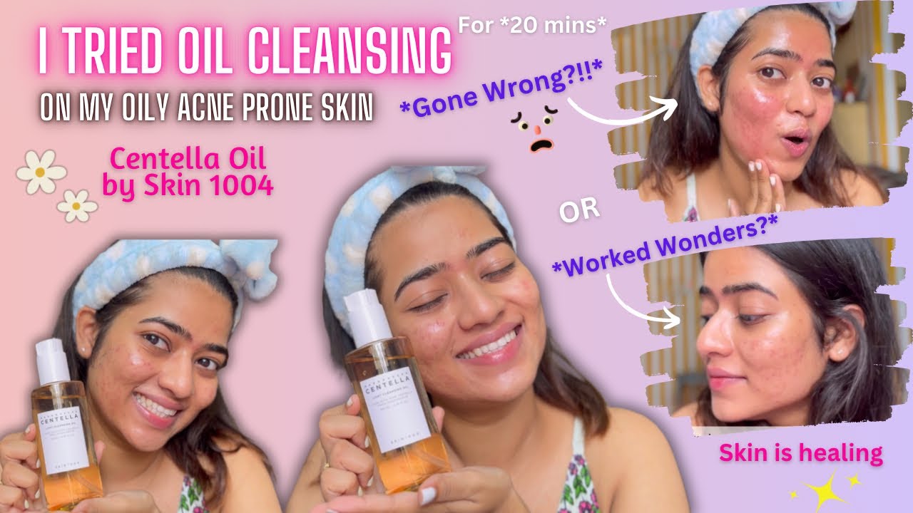 I Tried Oil Cleansing and THIS HAPPENED!! | Centella by Skin 1004 | Gauri Gajare Official
