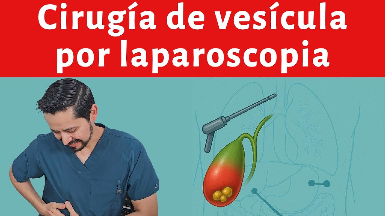 Operación de vesícula. Cómo es una colecistectomía, anestesia y recuperación.