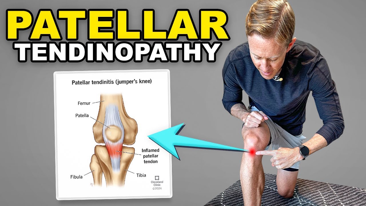 Patellar Tendon Rehab Exercises