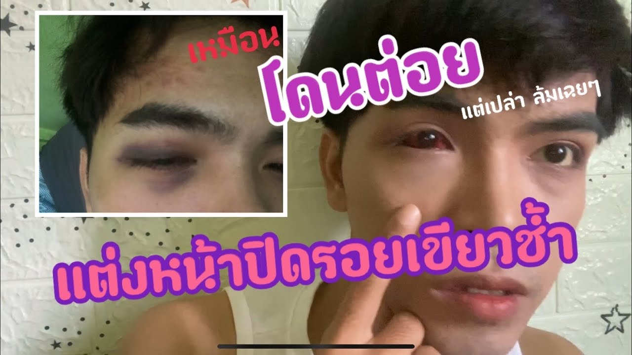 แต่งหน้าปิดร้อยช้ำเขียว  ที่ดวงตา