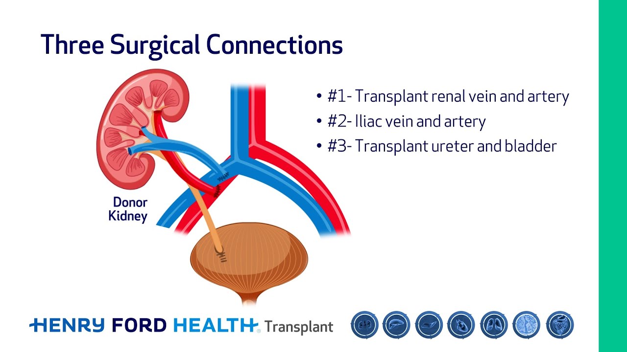 Kidney Transplant: Pre-Surgical Information