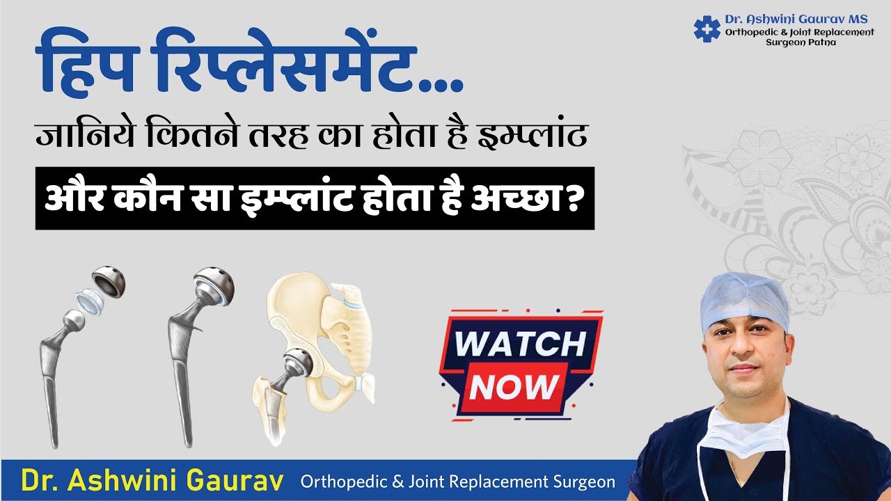 Types of Hip Replacement Implants | कुल्हे की रिप्लेसमेंट के लिए कितने प्रकार के इम्प्लांट होते हैं?