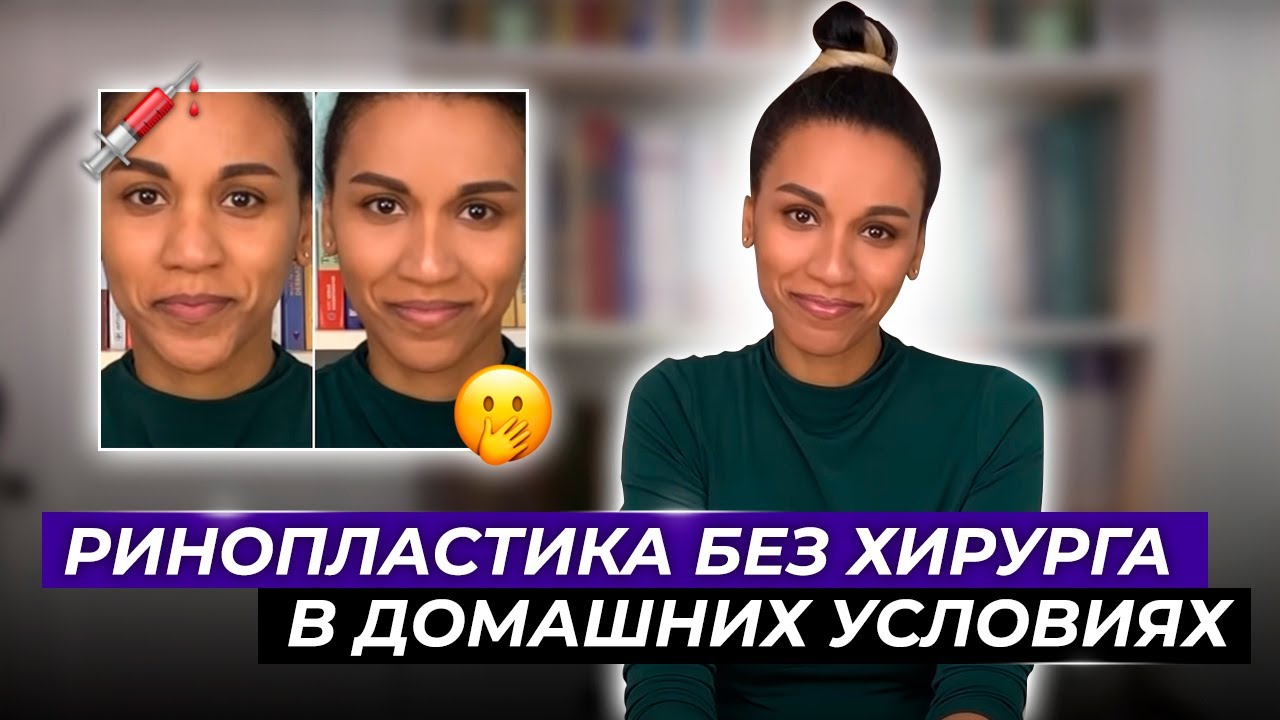 Шок! Мои пластические операции: ринопластика, ботокс, филлеры и лифтинг //Могу сама- хирург не нужен