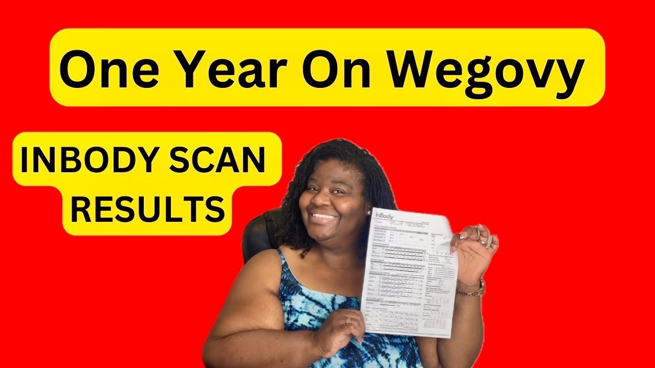 Wegovy Weight Loss Update | One Year Doctor appointment today #weightlossjourney #weightloss
