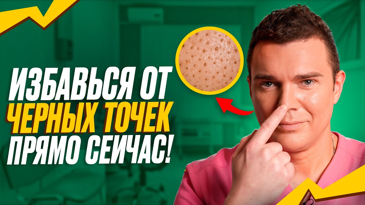 Черные ТОЧКИ на НОСУ? Вот как Правильно лечить САЛЬНЫЕ НИТИ!