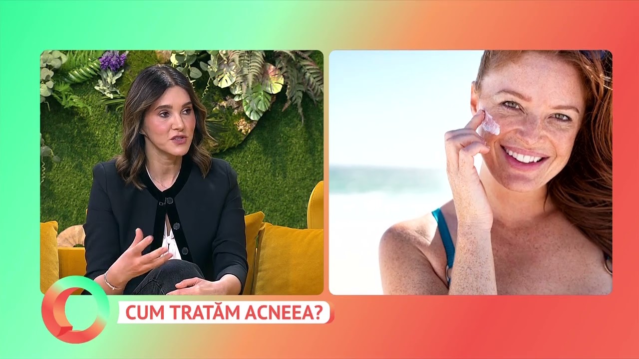 Cum tratăm acneea?