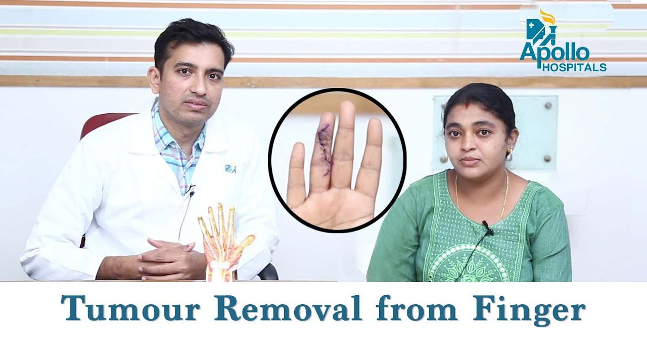 Tumour Removal from Finger | Patient Testimonial | Dr. Gopinath Bandari, Hand Wrist & Micro surgeon