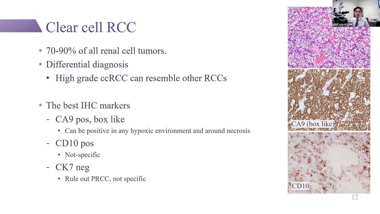 GUPS Virtual Education Series Metastatic renal cell carcinoma 06-06-2025