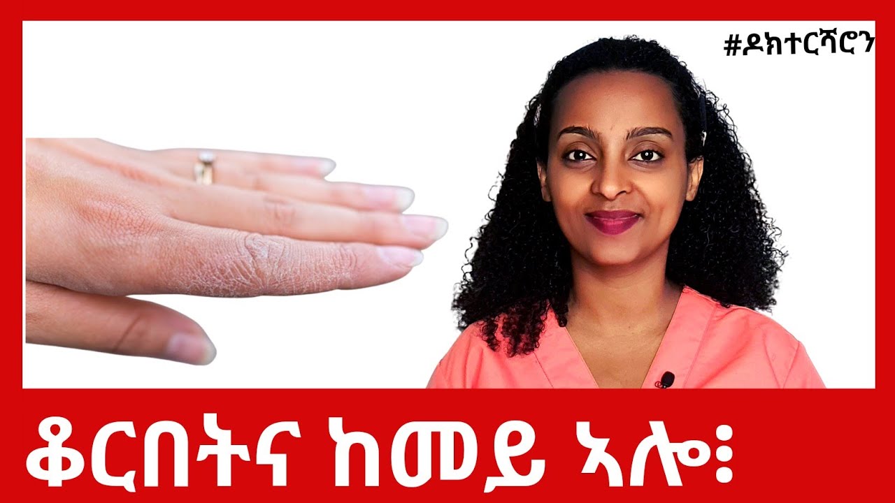 5 ጠንቅን ቀሊል ፍታሕን ንዝደረቐ ቆርበት #ዶክተርሻሮን