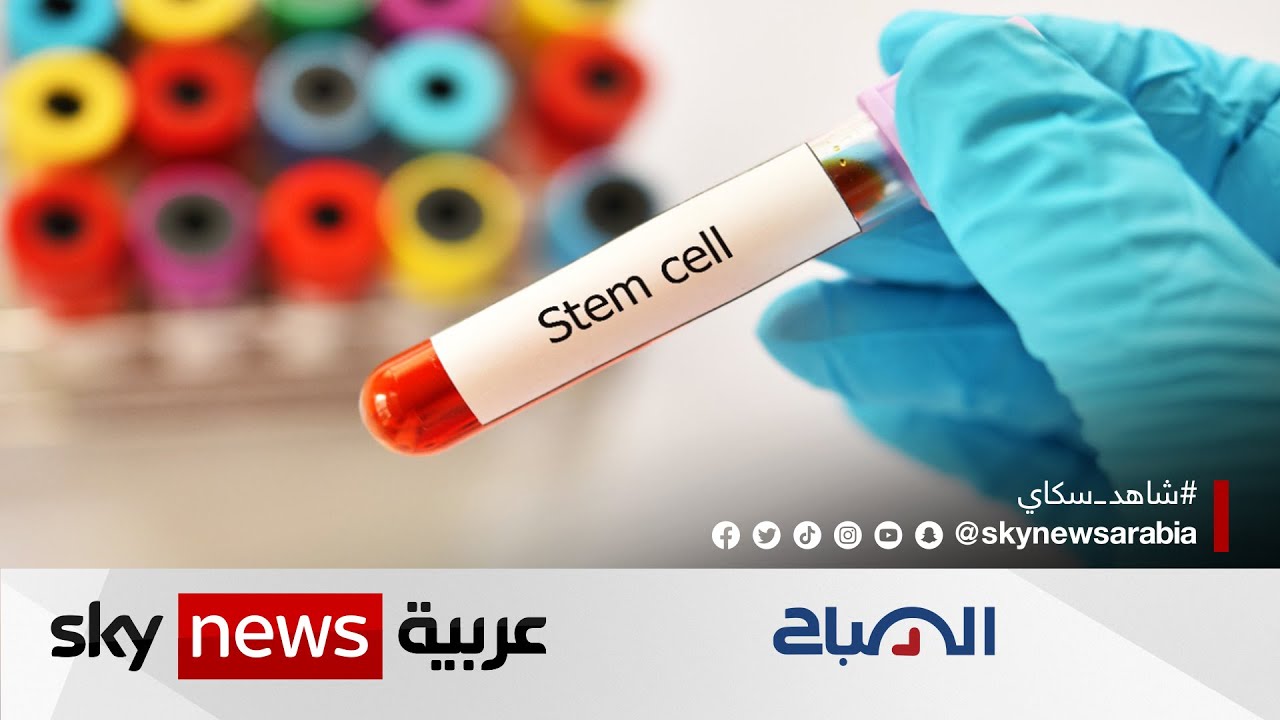 أبحاث: الخلايا الجذعية من الطرق الفعالة لعلاج سرطان الدم | #الصباح