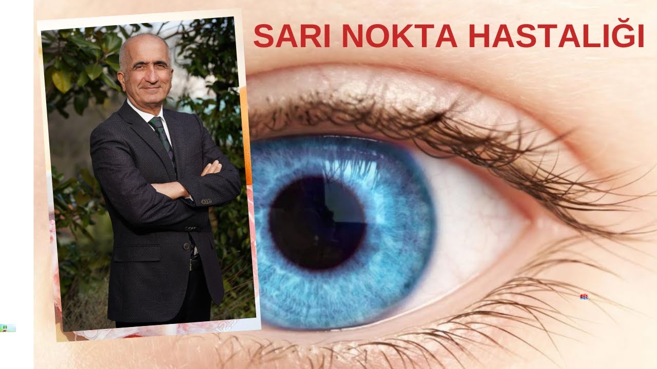 YAŞLANDIĞIMIZDA DAHA İYİ GÖRMEK İÇİN NE YAPALIM? SARI NOKTA HASTALIĞI -MAKÜLER  DEJENERASYON