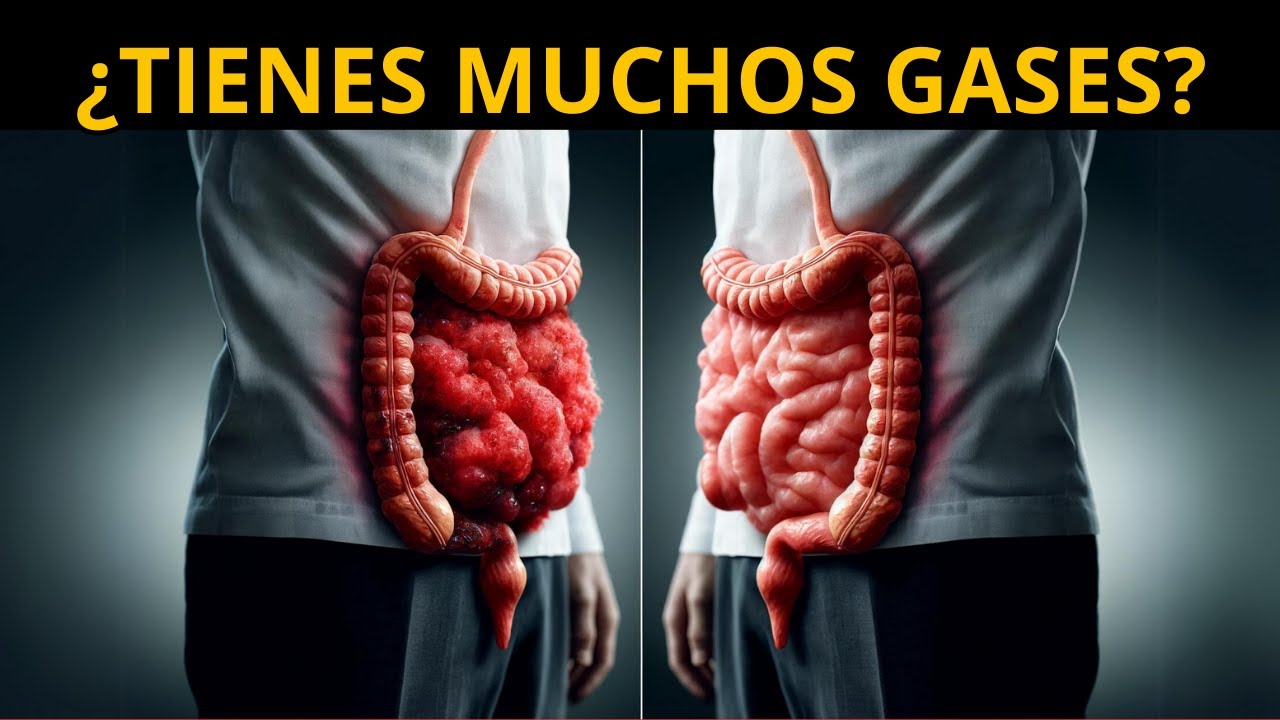 ¿POR QUÉ SE NOS HINCHA LA PANZA? - PRINCIPALES CAUSAS Y TRATAMIENTO