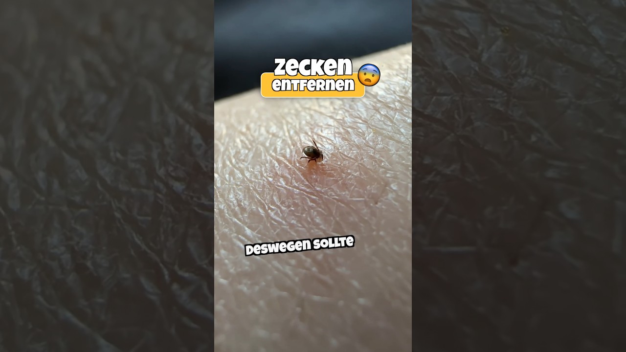 Zecken entfernen mit Zecken-Zange 🕷️