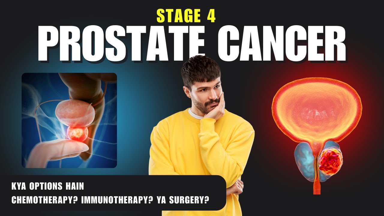 Stage 4 || Prostate cancer treatment options ||