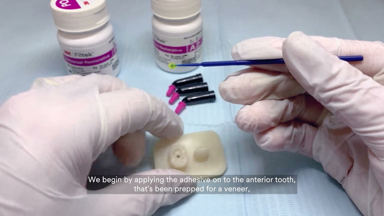 Filtek Universal Single Bond training video