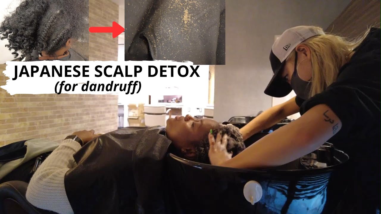 JAPANESE Scalp Examination, Cleansing and Detoxification for Intense Dandruff after 4 months Itch 😫
