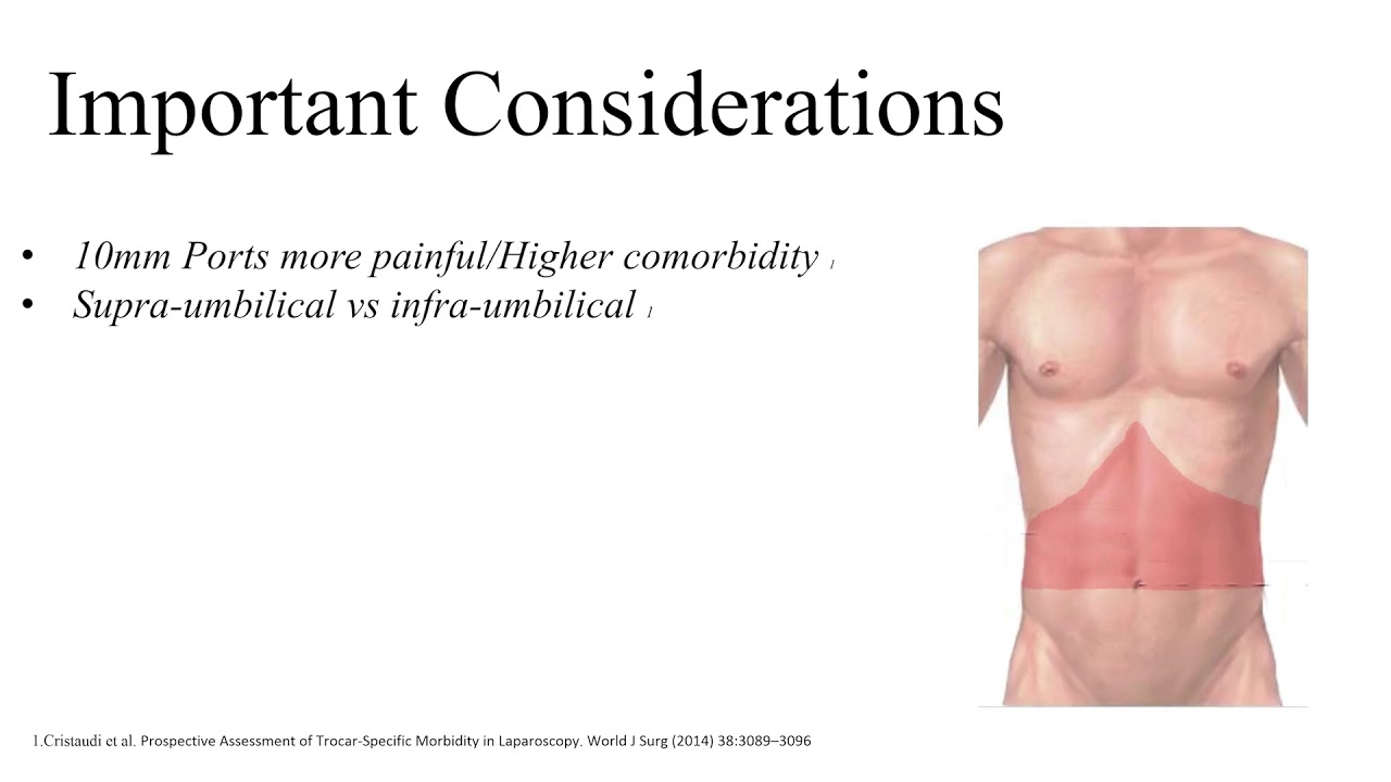Port Placement for Laparoscopic Colonic Resections