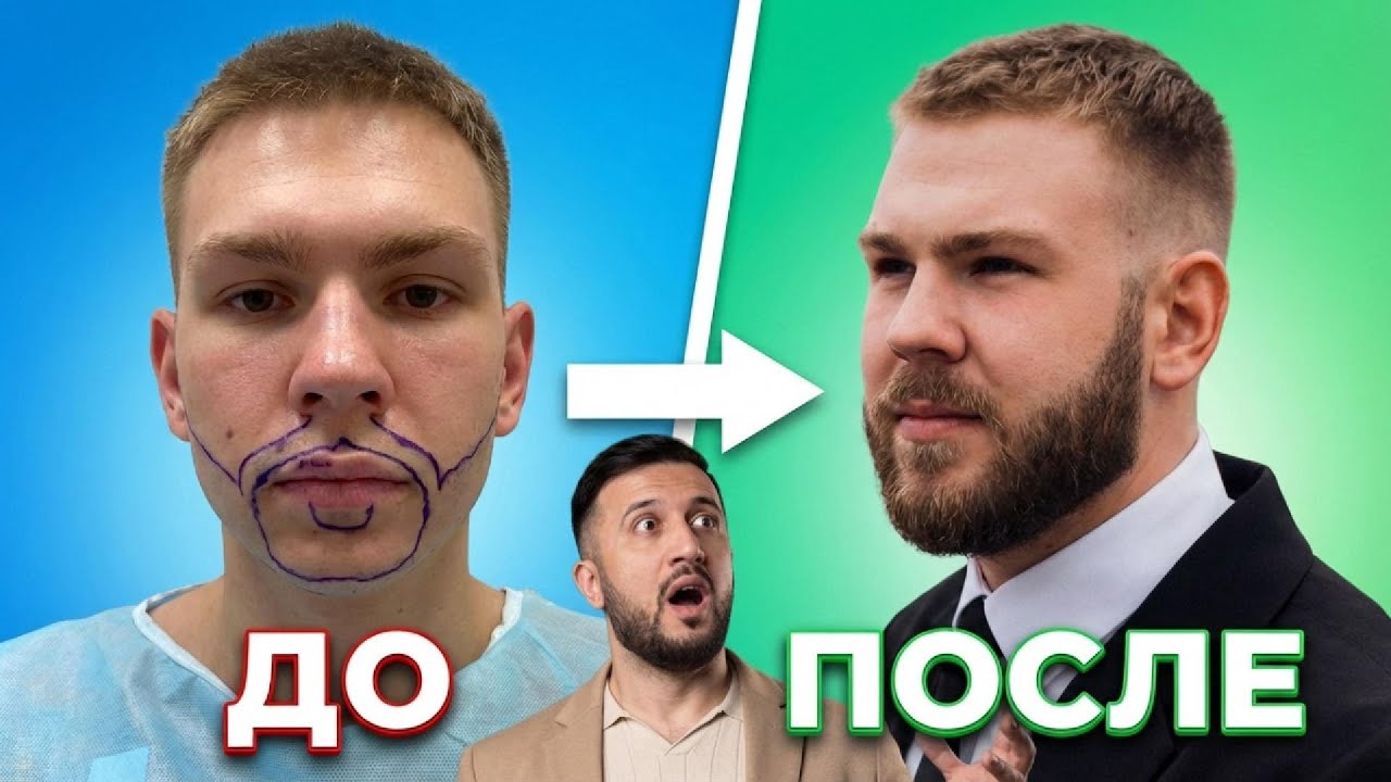 GG med и Turkey este hair отзыв о клиники по пересадки волос и бороды. Почему я рекомендую GG med?