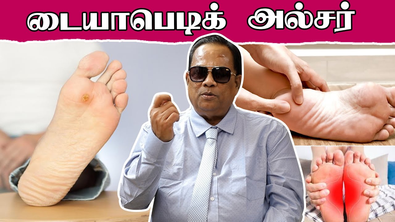 டயாபிடிக் அல்சர் / C K Nandagopalan