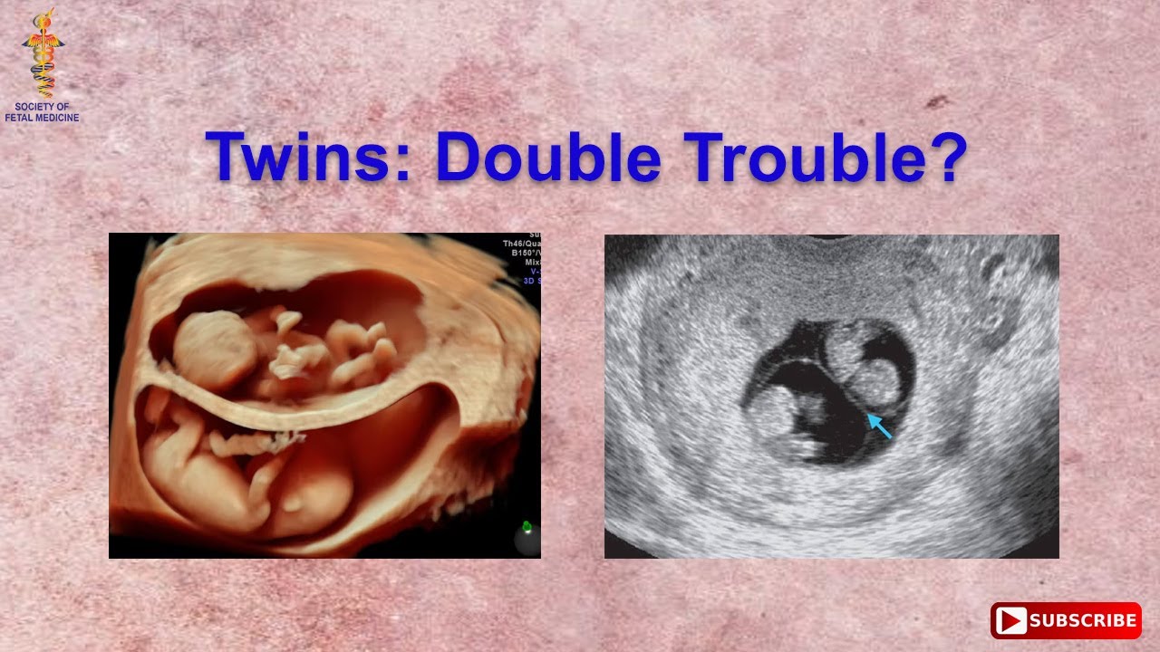 Twins: Double Trouble?